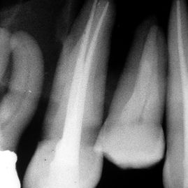Clínica de Ortodoncia Bárbara Milla odontología 3