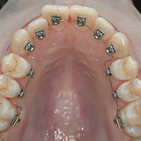 Clínica de Ortodoncia Bárbara Milla ortodoncia 2